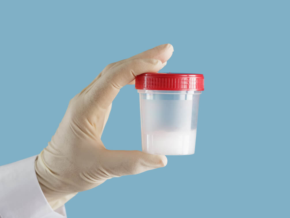 Donor Sperm